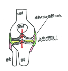 膝が痛くなる原因