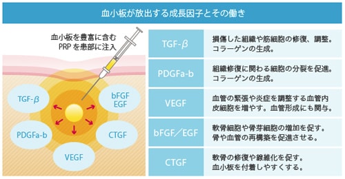 PRP治療で分泌される成長因子の種類